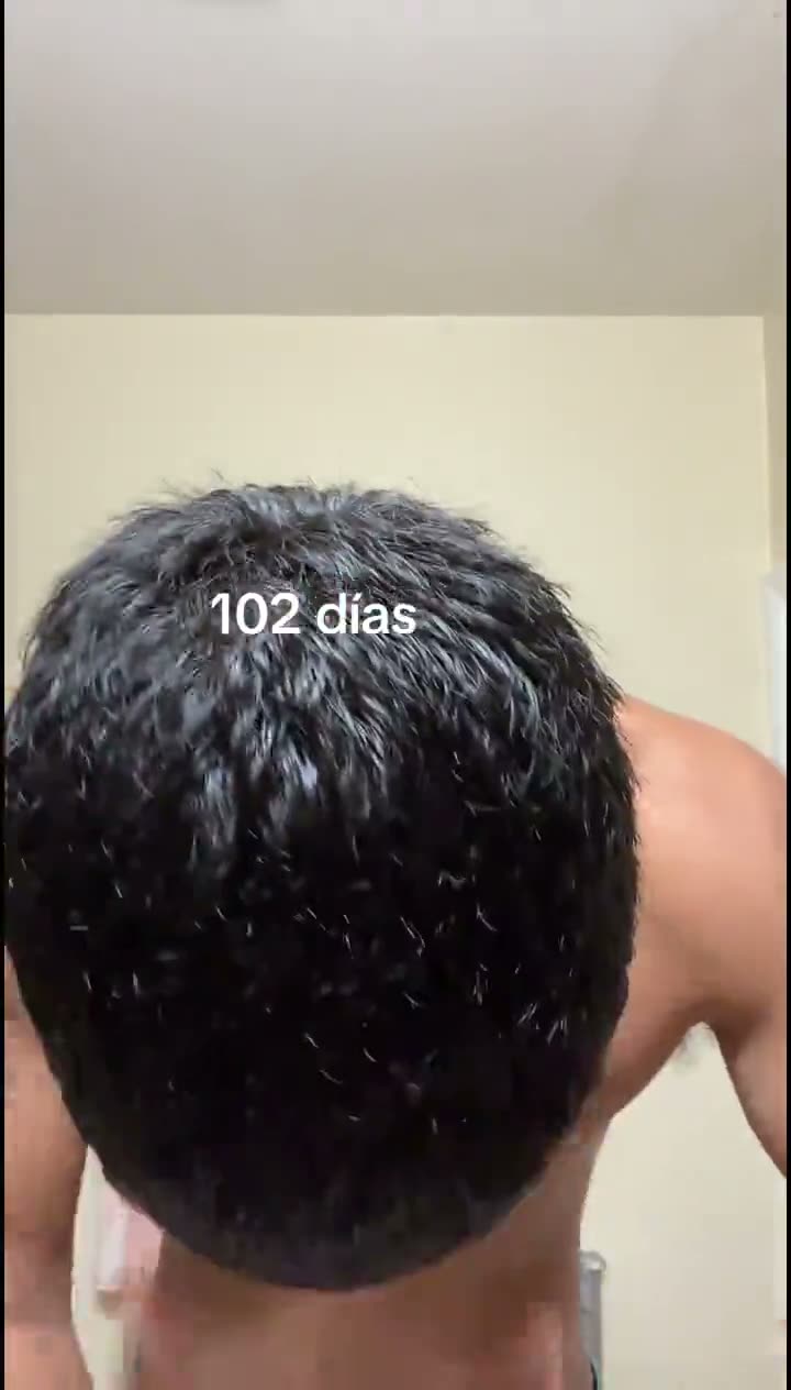 Customer scalp-care video still 03