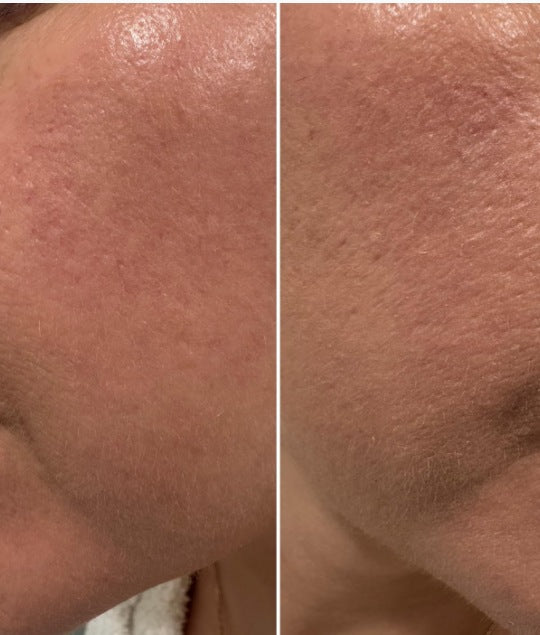 Customer-submitted split cheek photo showing skin before and after BB cream coverage