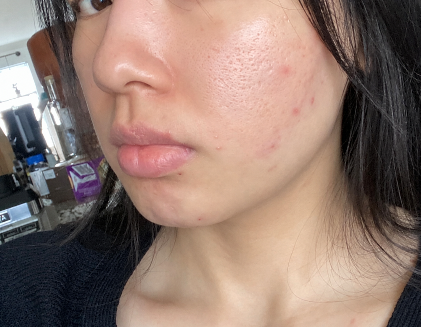 Customer-submitted close-up showing textured skin