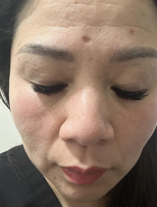 Customer-submitted close-up showing mature skin