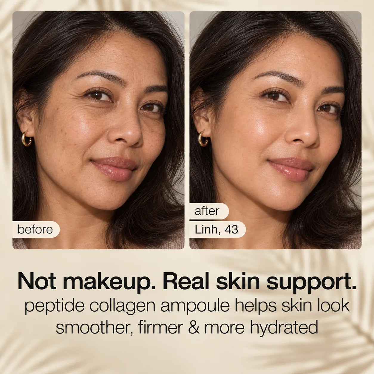 Supplied before-and-after visual result featuring Linh, age 43.