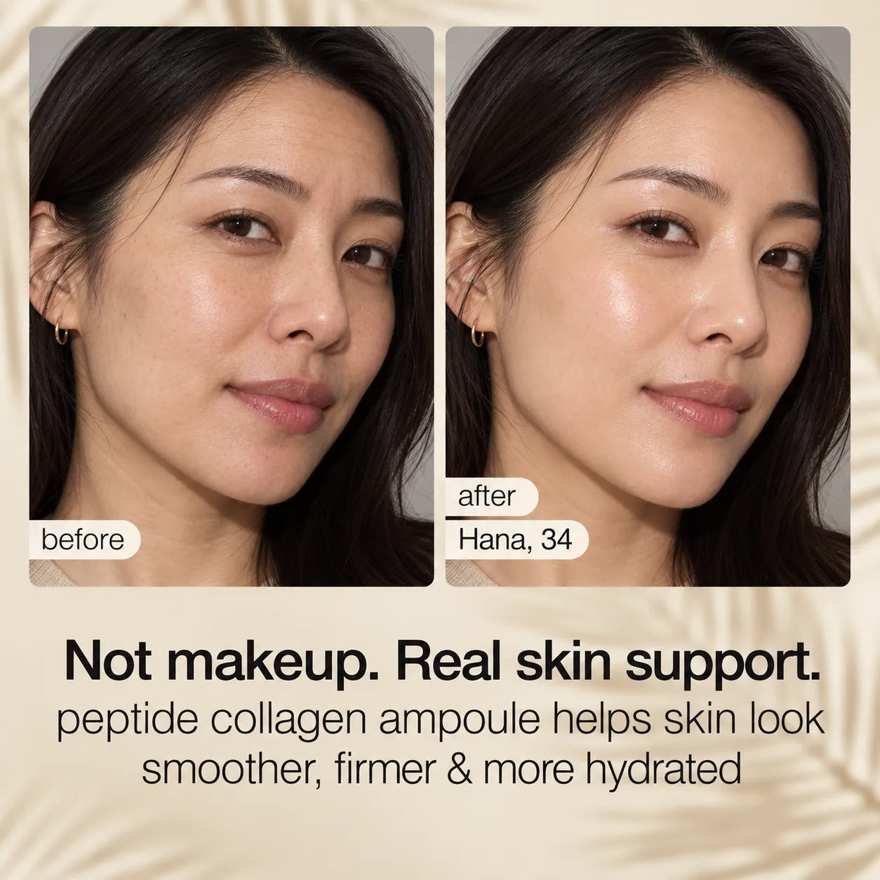 Supplied before-and-after visual result featuring Hana, age 34.