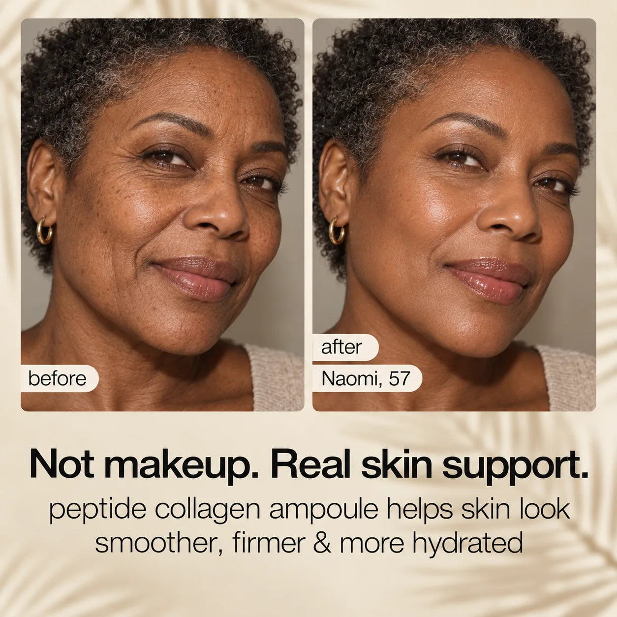 Supplied before-and-after visual result featuring Naomi, age 57.