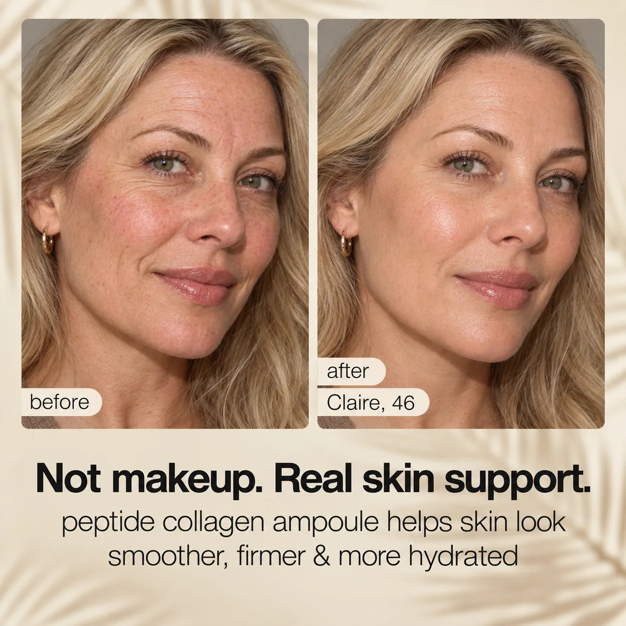 Supplied before-and-after visual result featuring Claire, age 46.