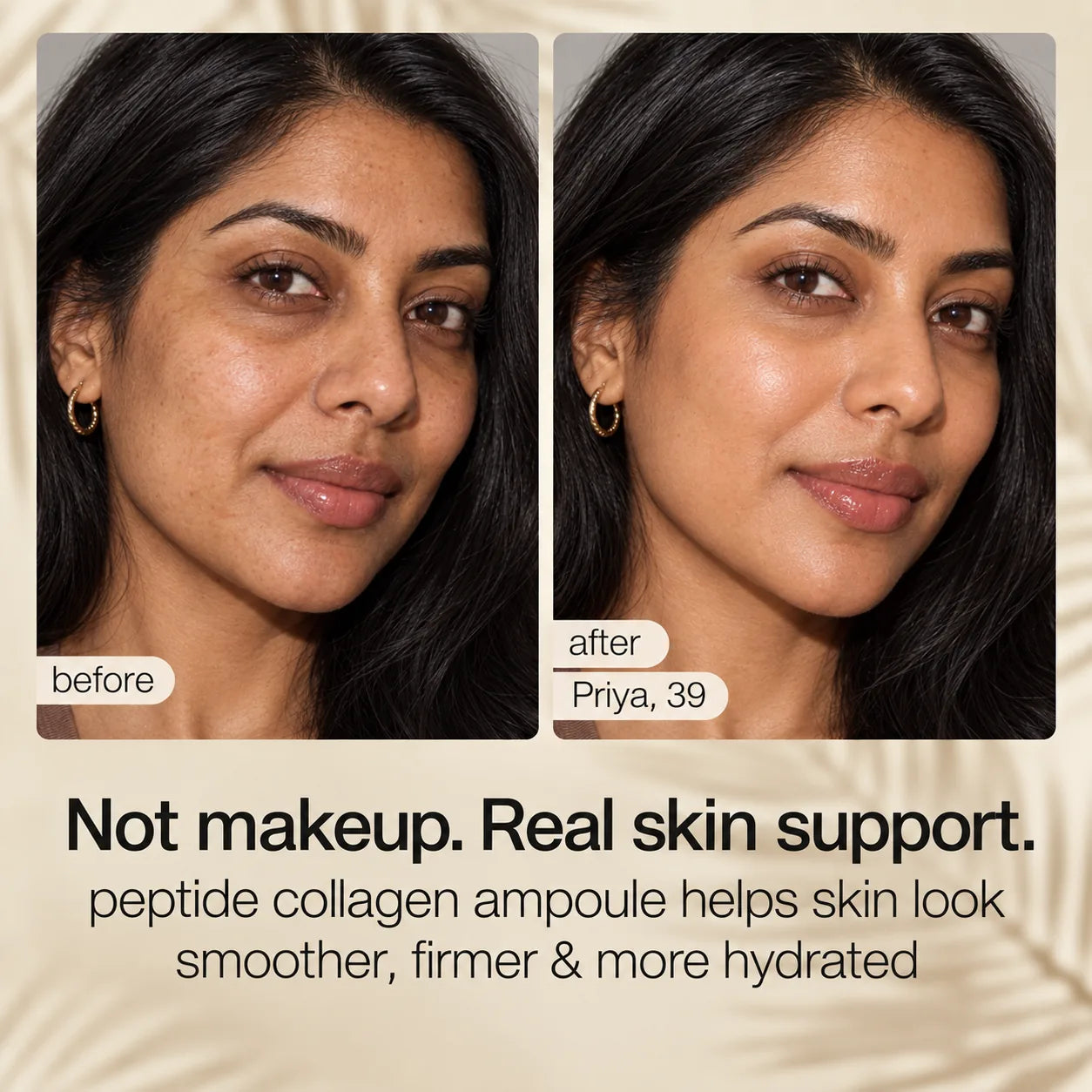 Supplied before-and-after visual result featuring Priya, age 39.