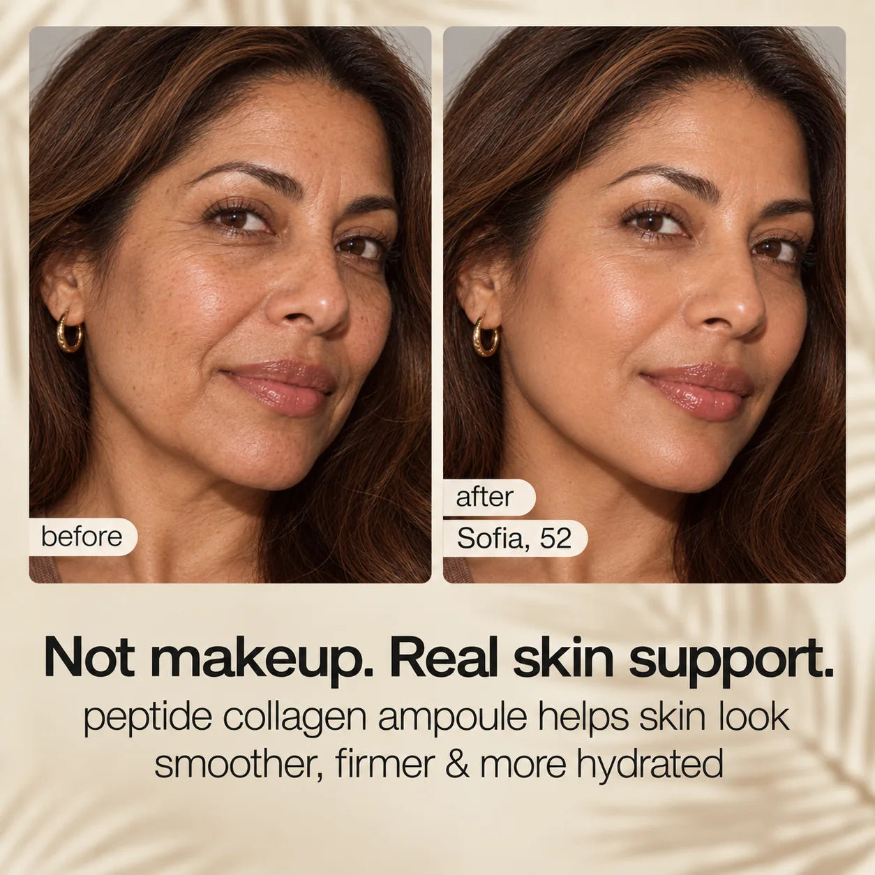 Supplied before-and-after visual result featuring Sofia, age 52.