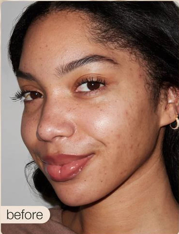 Parker before using HALOVA CC serum