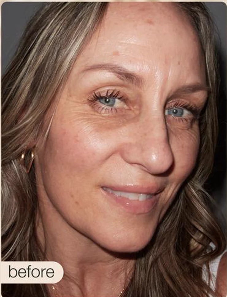 Kristin before using HALOVA CC serum